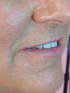 Permanent Lipstick Before
